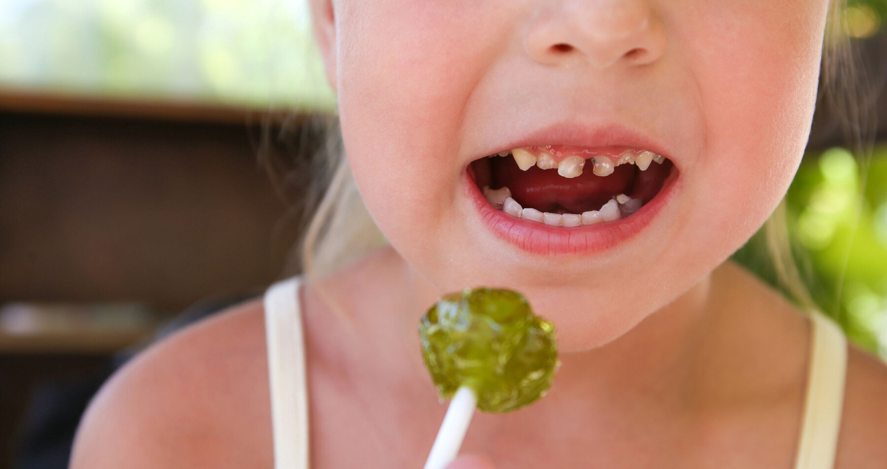Mädchen mit Lolli und Karies