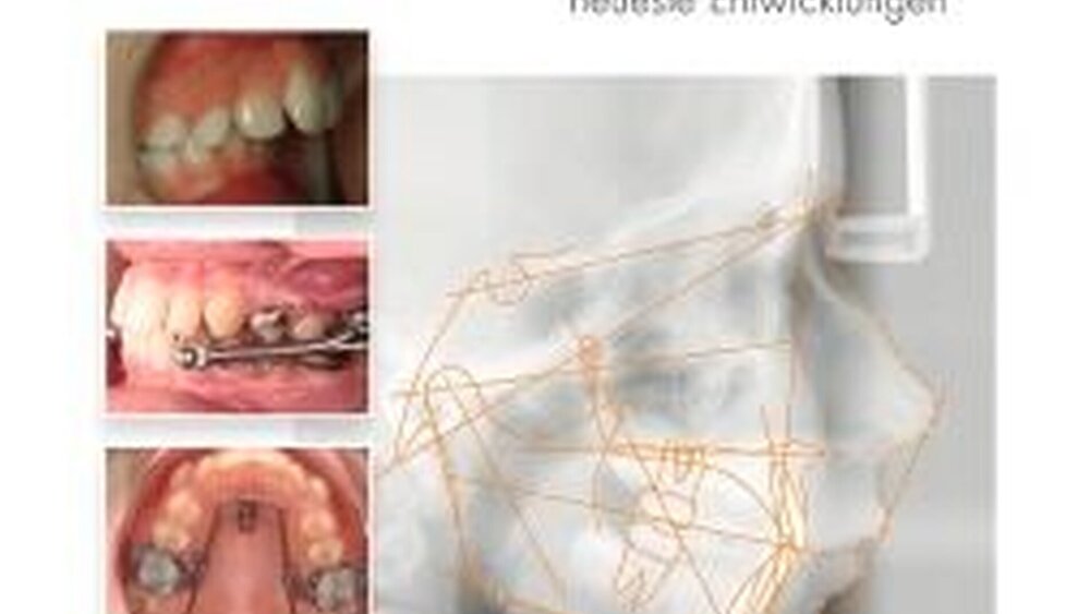 Martin Baxmann (Hrsg.): Festsitzende Apparaturen zur Klasse-II-Therapie. Bewährte Methoden und neueste Entwicklungen. ISBN: 978-3-86867-051-6188,00 Euro |