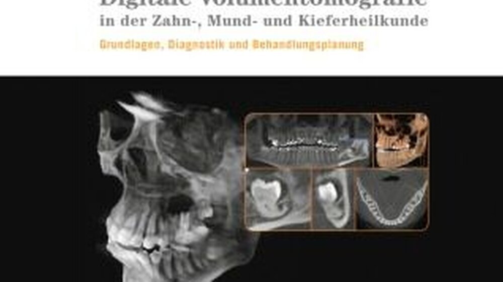 Joachim E. Zöller, Jörg Neugebauer: Digitale Volumentomografie in der ZMK. Grundlagen, Diagnostik und Therapieplanung. | Joachim E. Zöller, Jörg Neugebauer: Digitale Volumentomografie in der ZMK. Grundlagen, Diagnostik und Therapieplanung. |