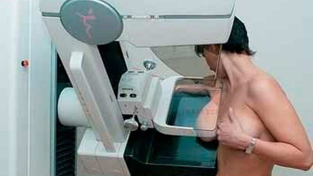 Patientin bei der Vorsorgemammographie