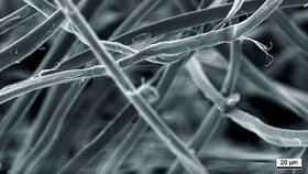 Abbildung 1: Elektronenmikroskopische Aufnahme von Seidenfäden ... |