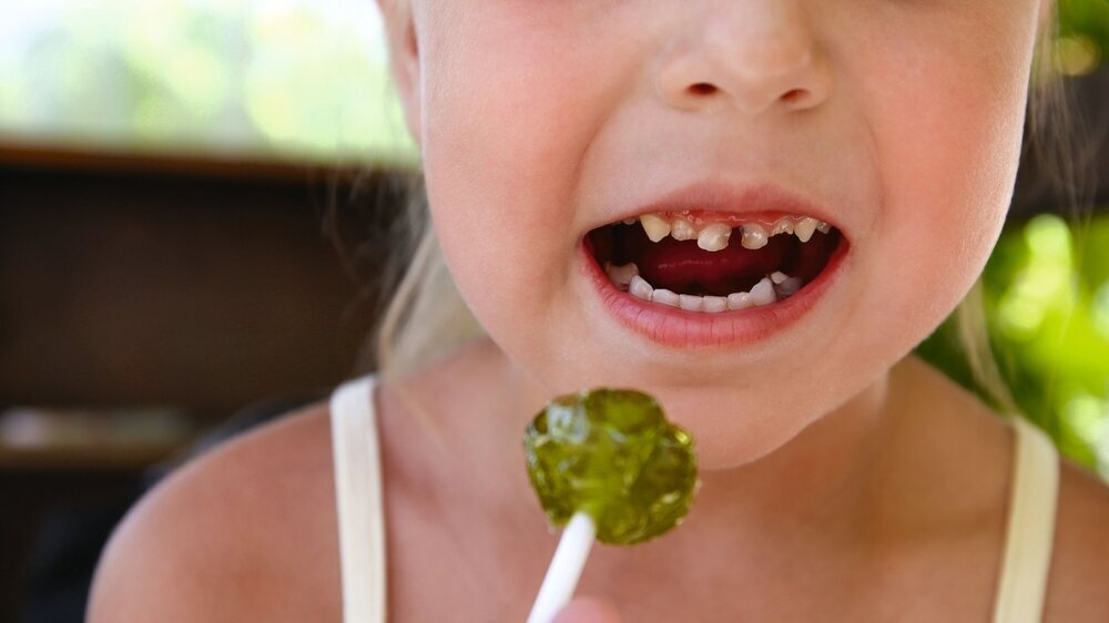 Mädchen mit Lolli und Karies