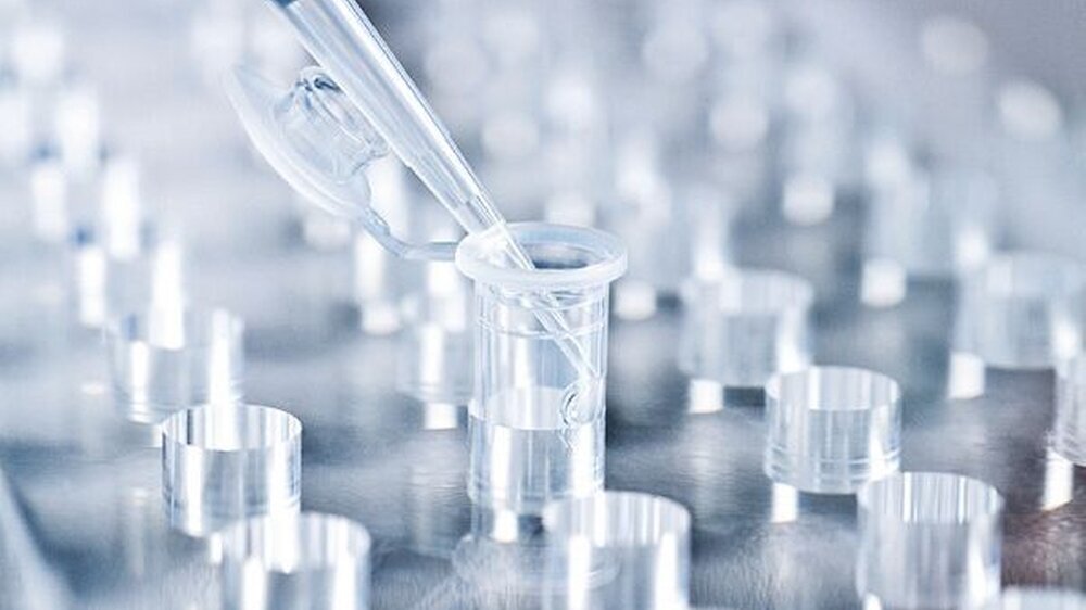 In den Labors der Pharmafirmen wird emsig an Impfstoffen geforscht, oftmals sehr gewinnbringend.