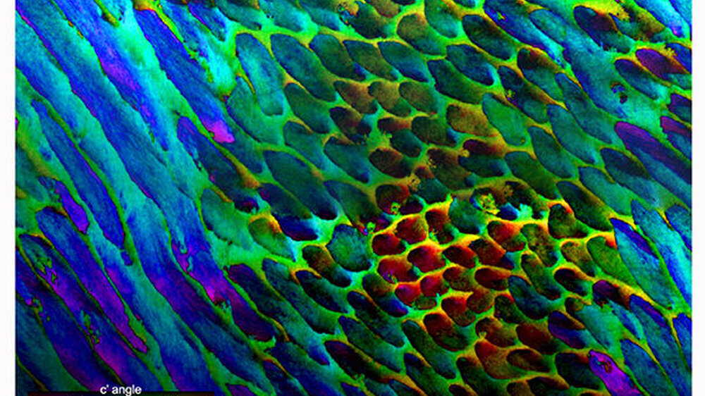 Die biomineralischen Kristalle im Zahnschmelz sind nicht perfekt ausgerichtet. Kleine fehlausgerichtete Winkel sind besser geeignet, Risse vom Druck, der zum Beispiel durch Kauen entsteht, abzulenken.