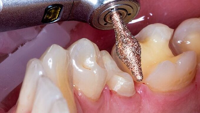 131546-flexible-1900.jpg 131546-flexible-1900.jpg