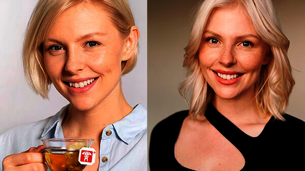 Caroline Lauffenburger vor (l.) und nachdem (r.) sie TrioClear-Aligner genutzt hat.