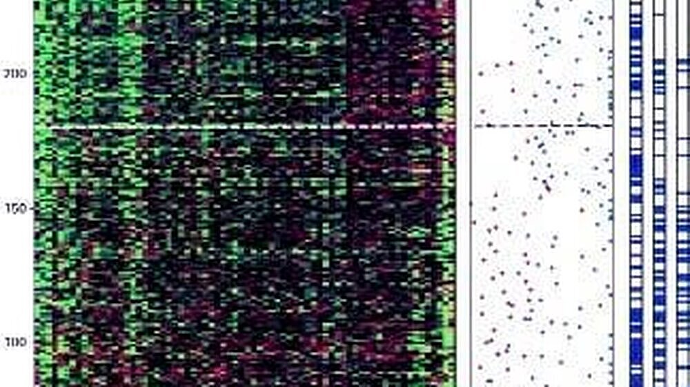 Abb. 1: Expression der 70 Marker-Gene bei den untersuchten 295 Patientinnen mit Mamma-Ca. Die rote Farbe korrespondiert mit einer hohen Genexpression im Tumormaterial der jeweiligen Patientin und so mit einem schlechten Risiko. Rechts angegeben ist eine M