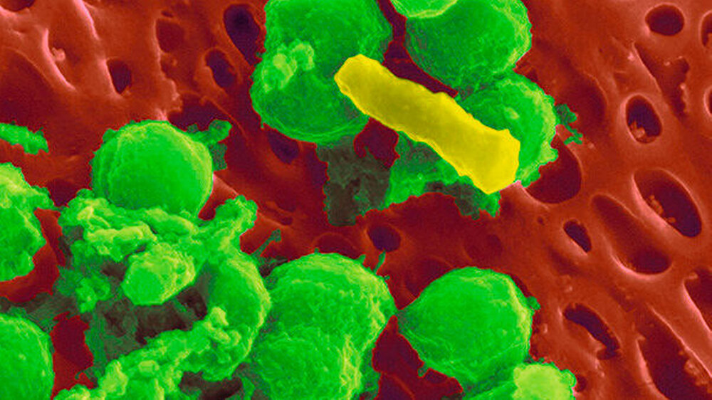Streptococcus- mutans-Bakterien in der Kolonie