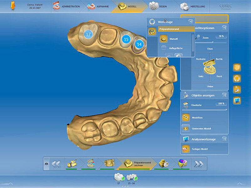 CAD/CAM-Technologie für mehr Indikationen denn je - zm-online