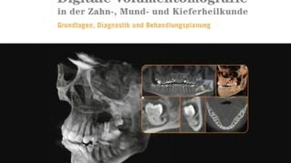 Joachim E. Zöller, Jörg Neugebauer: Digitale Volumentomografie in der ZMK. Grundlagen, Diagnostik und Therapieplanung. |