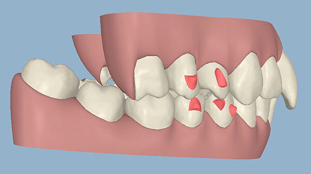 Abbildung 3d: Die Ausgangssituation im Clinical Check, rechts