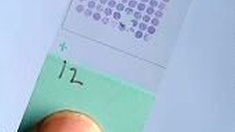 Ein Biochip – die Analysenwerkzeuge im Miniformat sehen aus wie gewöhnliche Objektträger für die Mikroskopie, können aber das gesamte menschliche Genom beherbergen.