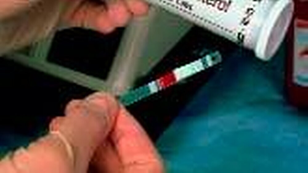 Blut-Cholesterin ein Mal pro Jahr testen