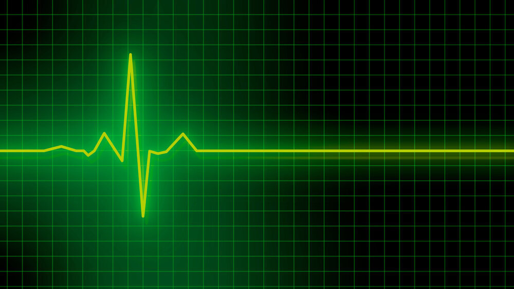 Cardiogram on a green screen monitor Cardiogram on a green screen monitor