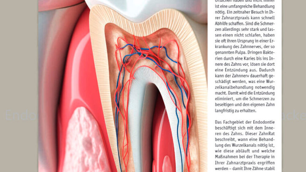 ZahnRat 125: Endodontie