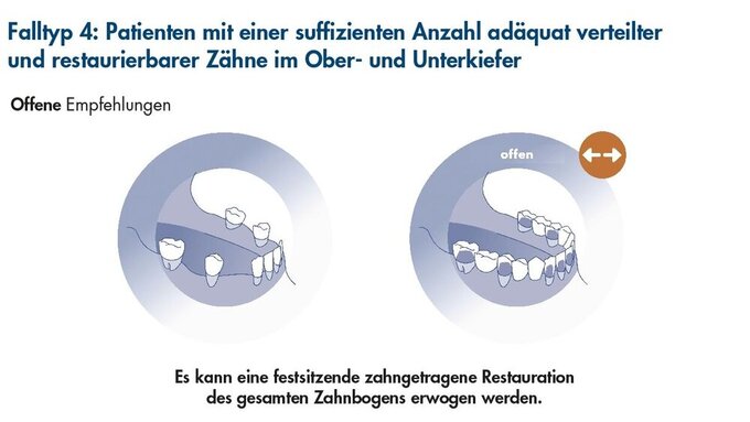 Falltyp_4_Abbildung_1