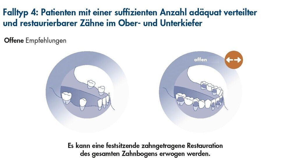 Falltyp_4_Abbildung_1