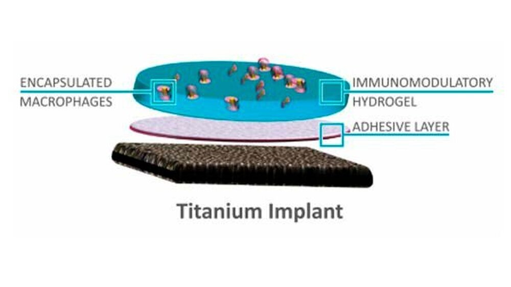 Diese Gelschicht soll Implantate verbessern: In das Gel sind Makrophagen und Immunmodulatorzellen integriert, die die Einheilung verbessern und Komplikationen verhindern sollen.