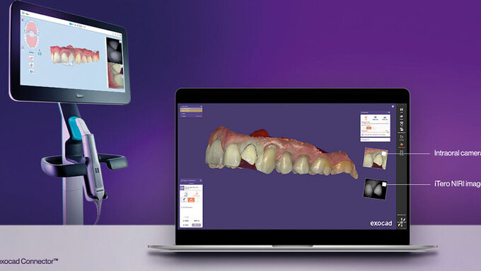 280604-flexible-1900.jpg 280604-flexible-1900.jpg