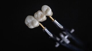 Themenfoto: Nahaufnahme einer keramischen Zahnbrücke, die mit einer Metallpinzette gehalten wird.