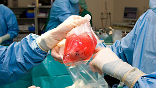Nierentransplantation