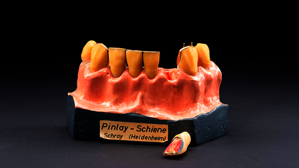 Abb. 1: Modell einer Pinley-Schiene, um 1980\r\n\r\n