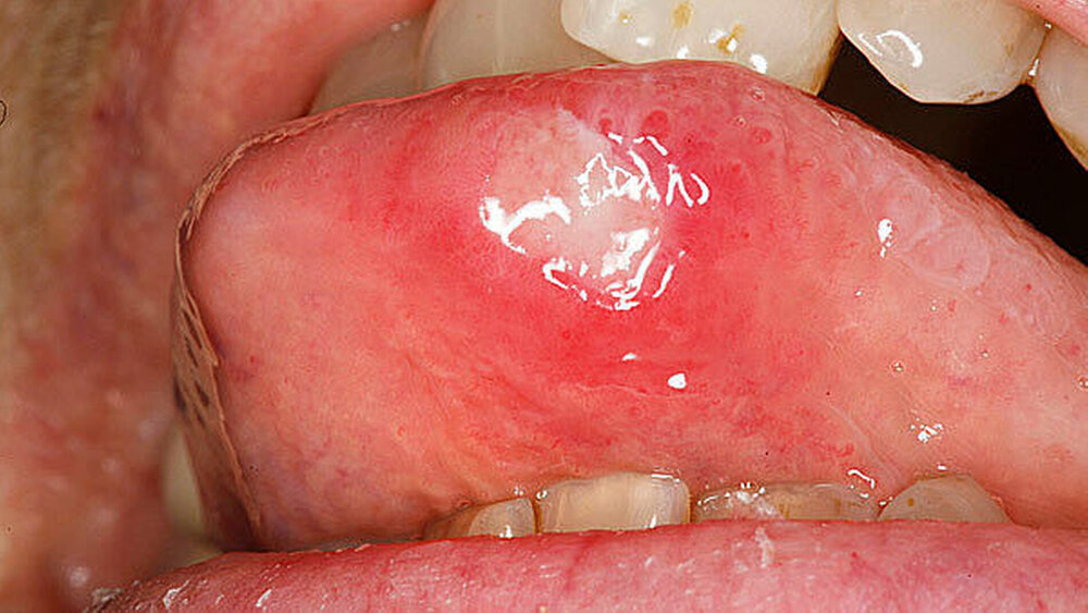 146808-flexible-1900 146808-flexible-1900