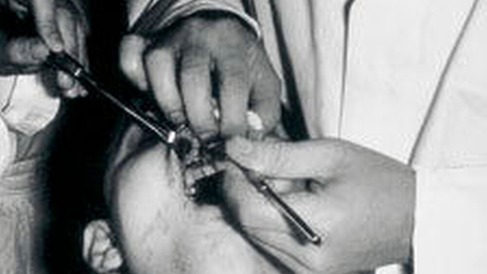 Parodontalchirurgie 1968: Einiges hat sich inzwischen verändert. |