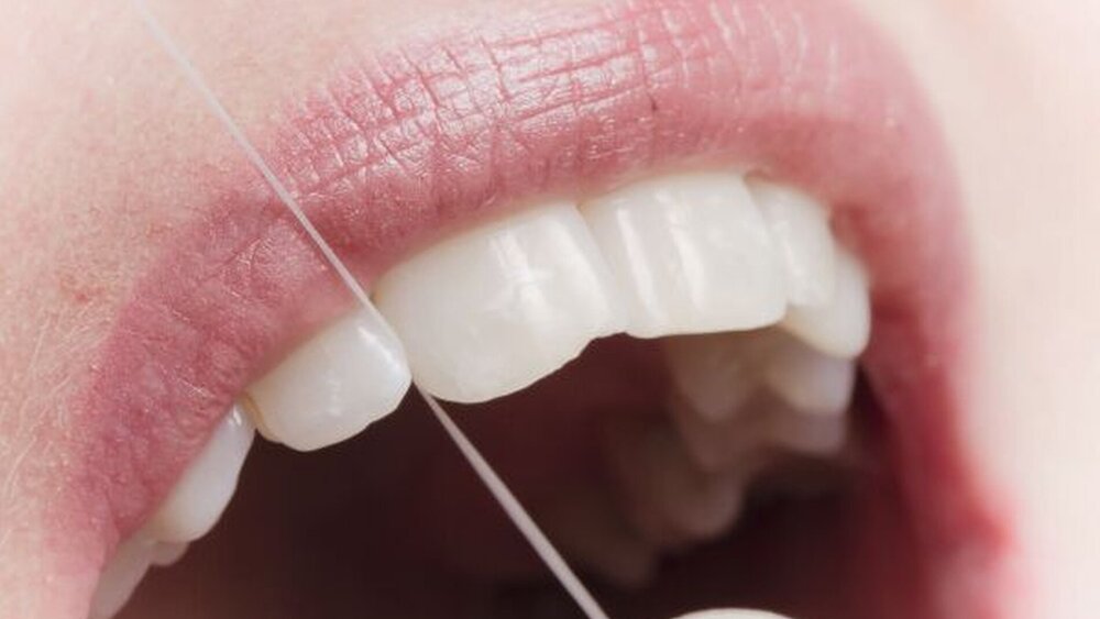 Zahnerhalt ist Teamsache: Erst das Paket aus Prophylaxe und zahnmedizinischer Versorgung erfüllt die Anforderung der SGB-V-Forderung „ausreichend, zweckmäßig und wirtschaftlich“. |