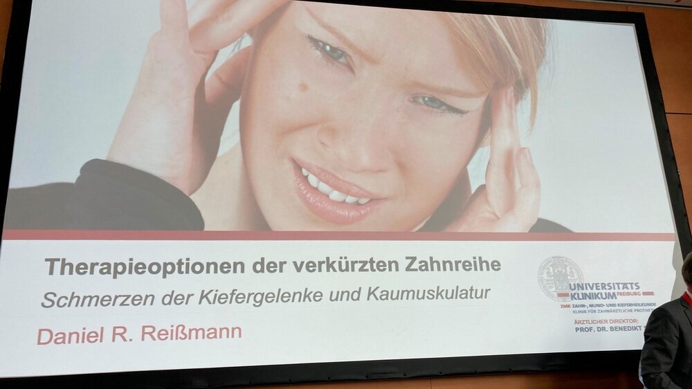 Das Konzept der verkürzten Zahnreihe funktioniert: Die multizentrisch durchgeführte RaSDA-Studie (randomized shortened dental arch) konnte binnen der 15-jährigen Studiendauer klinisch hoch relevante Ergebnisse zur Parodontalgesundheit, zum Entstehen von CMD-Beschwerden, dem Zahnverlust sowie der Prognose der prothetischen Versorgung liefern. Die Patienten wurden randomisiert nach dem Konzept der verkürzten Zahnreihe oder mit einer Geschiebeprothese zum Molarenersatz behandelt. Entsprechend der Einschlusskriterien, erfolgte bei einzelnen Patienten keine prothetische Therapie, während andere auf stärker reduzierten Restzahnbeständen bis hin zu nur 4 Restzähnen (beide Eckzähne und je einem Prämolar rechts und links) umfassend mit festsitzendem oder kombiniertem Zahnersatzes versorgt worden sind. Im Rahmen eines Symposiums auf dem Deutschen Zahnärztetag konnten die Professoren Walter (Dresden), Reißmann (Freiburg) und Luthardt (Ulm) als Vertreter aus dem RaSDA Studienteam die Ergebnisse bewerten. Zusammenfassend kann geschlussfolgert werden, dass der Präferenz der Patienten zugunsten einer der beiden Therapiealternativen „Verkürzte Zahnreihe“ beziehungsweise „Molarenersatz“ wenn immer möglich entsprochen werden soll. Patienten mit bereits erfolgten Zahnverlust haben ein erhöhtes Risiko für weiteren Zahnverlust. Ungeachtet dessen kann die Mehrzahl der Patienten über mehr als zehn Jahre erfolgreich mit dem jeweiligen Konzept behandelt werden. Bei Patienten, welche zu Therapiebeginn keine Zeichen einer Craniomandibulären Dysfunktion aufweisen, besteht kein Risiko des Entstehens Craniomandibulärer Dysfunktion, wenn keine Molaren ersetzt werden.