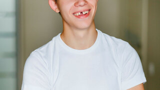 young man without front tooth