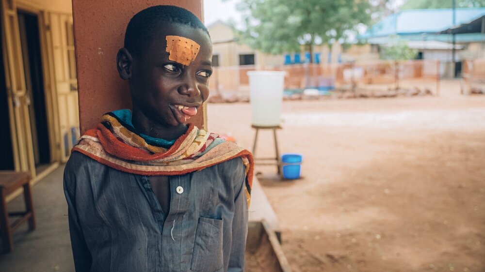 Abdulwahab, a 16-year-old noma survivor from Tsafe, Zamfara state, in the courtyard of the Sokoto Noma Hospital. Abdulwahab wants to stay in Noma Hospital forever. He knows he can’t, but he so much enjoys the peaceful atmosphere. May 1, 2023.