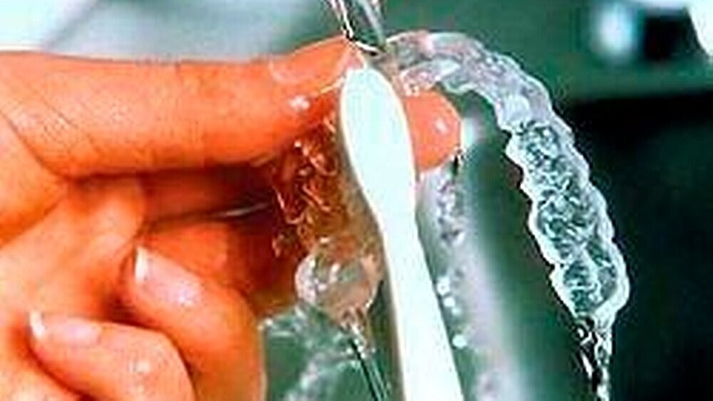 Abb 1: Mit zuhause anwendbaren Schienen und zehnprozentigem Karbamidperoxid-Gel lassen sich sehr gute Bleichergebnisse erzielen.