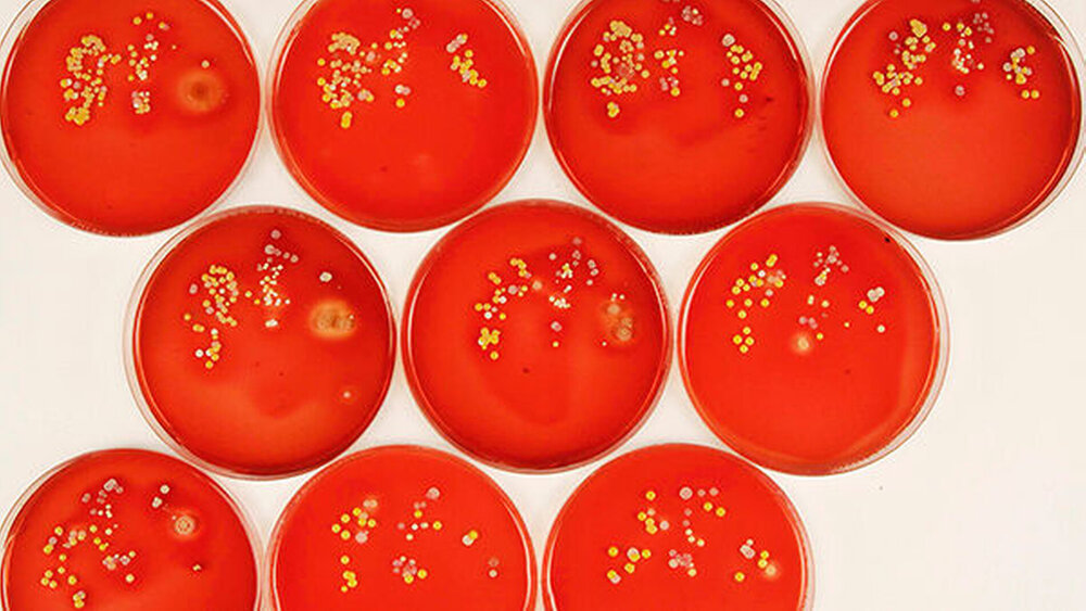 Abbildung 1: Aufeinander folgende Kontaktkulturen der nicht desinfizierten Fingerspitzen von Zeige-, Mittel- und Ringfinger der gleichen Hand. |