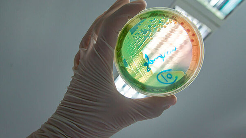Das Bakterium Pseudomonas aeruginosa ist gegenüber verschiedenen Antibiotika resistent. In Deutschland gehört es zu den am häufigsten auftretenden Krankenhauskeimen.