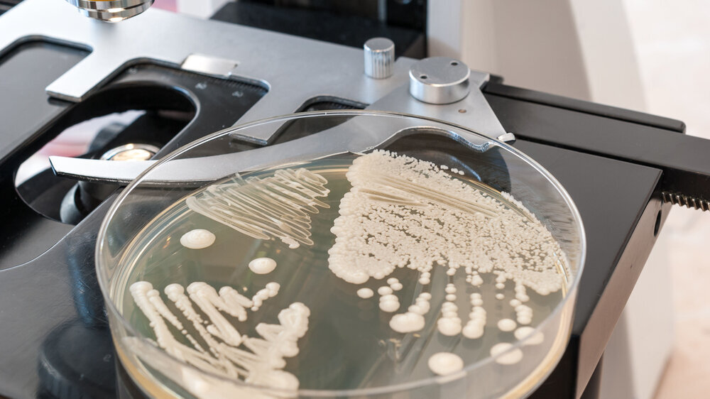 Candida albicans