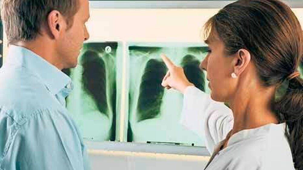 Der Diagnose Lungenkrebs geht in den meisten Fällen eine jahrelange Nikotinsucht voraus.