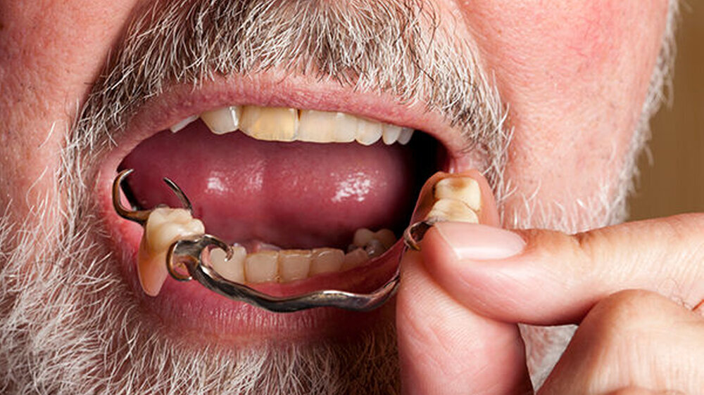 Raus und weg? Laut British Dental Association ist es in Großbritannien kein Einzelfall, wenn die Prothese plötzlich verschwindet.
