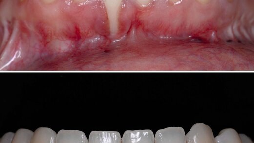361102-flexible-1900 361102-flexible-1900