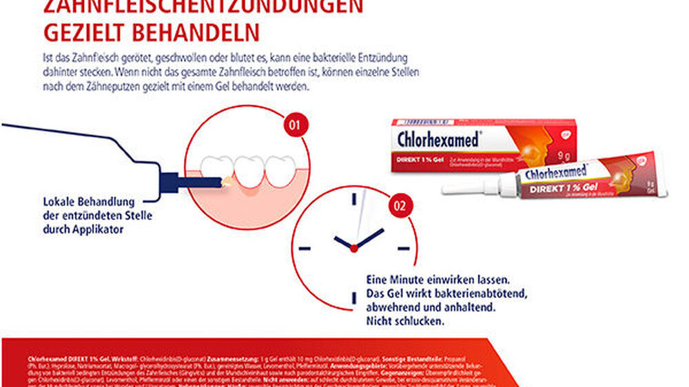Chlorhexamed ist die von Zahnärzten am häufigsten empfohlene Marke bei Gingivitis. Um entzündetes Zahnfleisch an einzelnen Stellen gezielt wieder auf Kurs zu bringen, bietet die Chlorhexamed-Familie zwei Gele.
