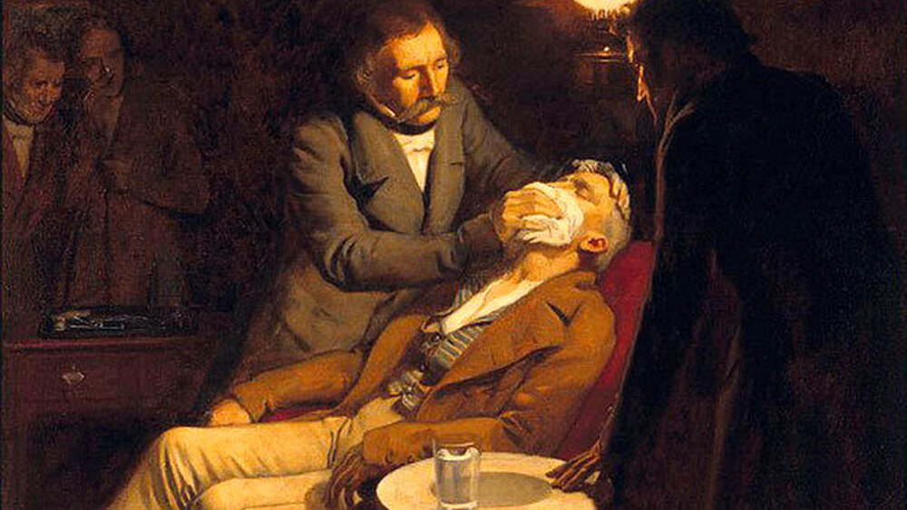 So sah der Maler Ernst Board die erste Äthernarkose, die 1846 von William Thomas Green Morton durchgeführt wurde. Gemälde um 1920. | So sah der Maler Ernst Board die erste Äthernarkose, die 1846 von William Thomas Green Morton durchgeführt wurde. Gemälde um 1920. |