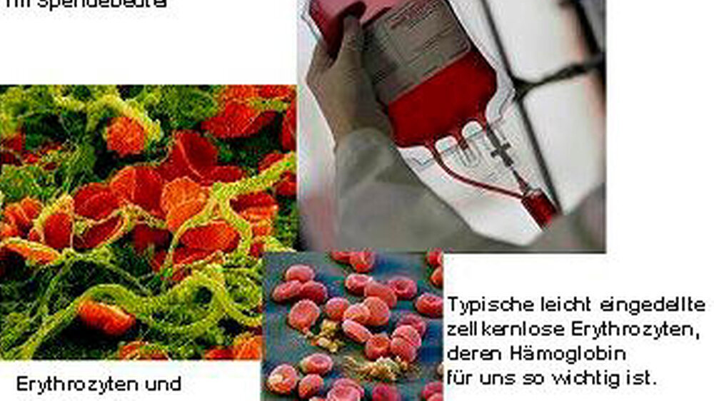 Erythrozyten und Fibrinfasern \r\nHier sind sie gut verpackt im Spendebeutel. \r\nTypische leicht eingedellte zellkernlose Erythrozyten, deren Hämoglobin für uns so wichtig ist.