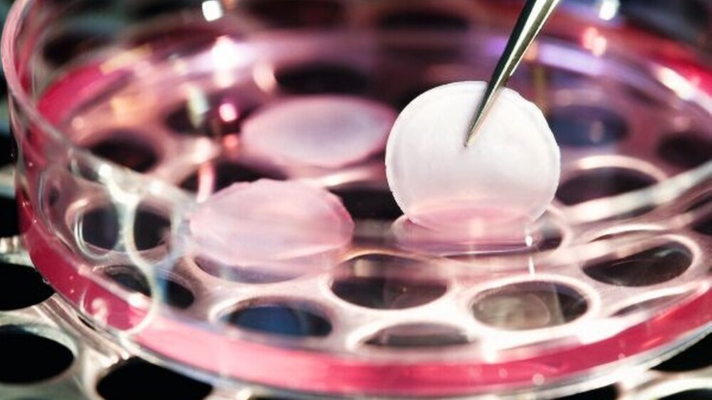 Beim Tissue Engineering wird durch Zellkultivierung biologisches Gewebe künstlich hergestellt. Damit kann krankes Gewebe erneuert oder regeneriert werden.