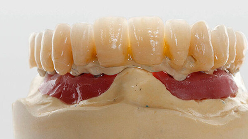 e.max frontal
