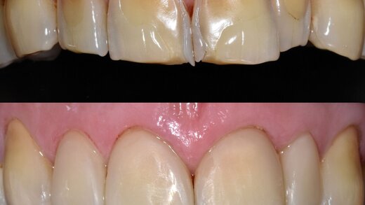 417497-flexible-1900 417497-flexible-1900