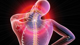 Nackenschmerzen, Fibromyalgie