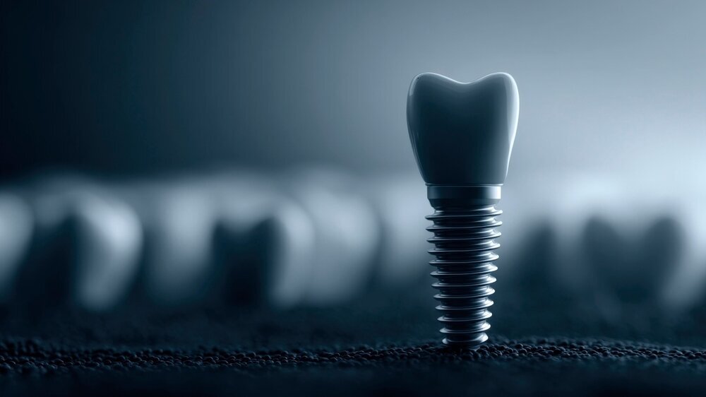 Implantat