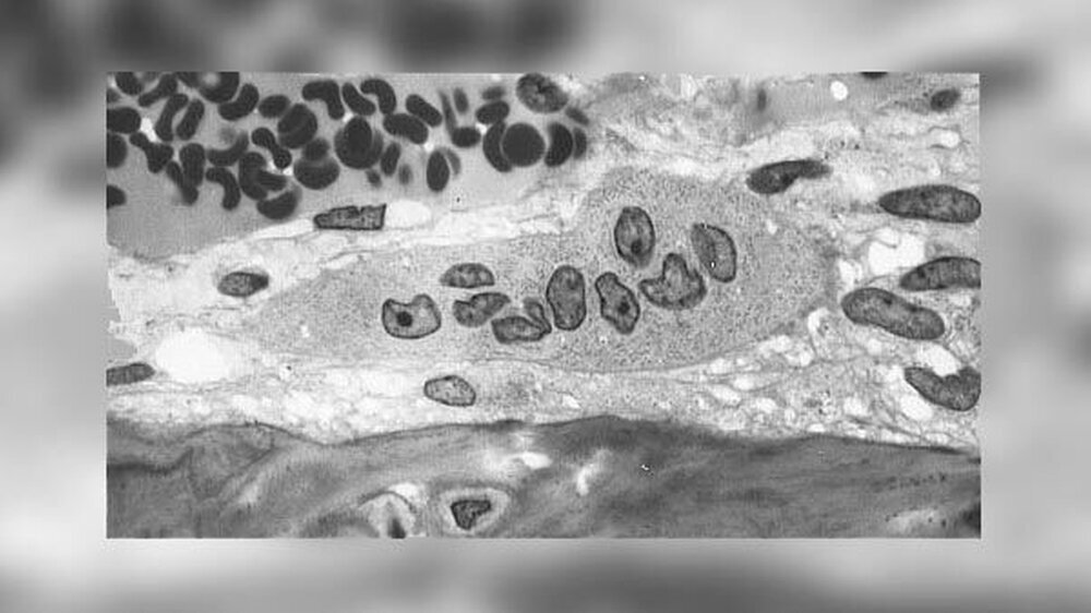 60 Tagen nach der Extraktion erfolgte die Implantation und die Forscher untersuchten den gewonnenen Bohrkern histologisch. Sie betrachteten dabei die Knochenstruktur und bestimmten die Relation von Osteoklasten (Transmissionselektronenmikroskopische Aufna
