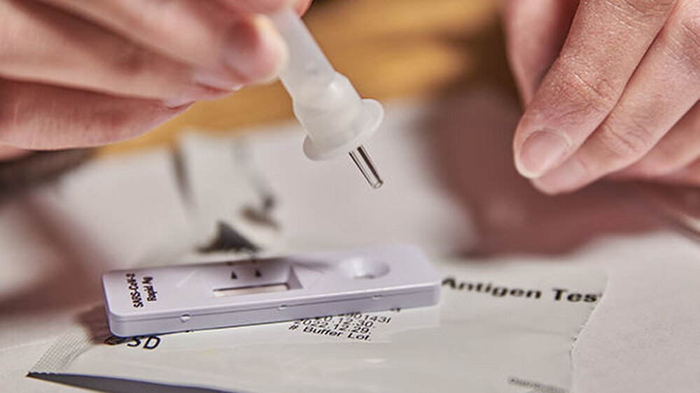 Schnelltests sind eine geeignete Maßnahme, um den Status eines Patienten zu bewerten und über den Behandlungsweg zu entscheiden, lautet das Fazit einer neuen US-Studie.