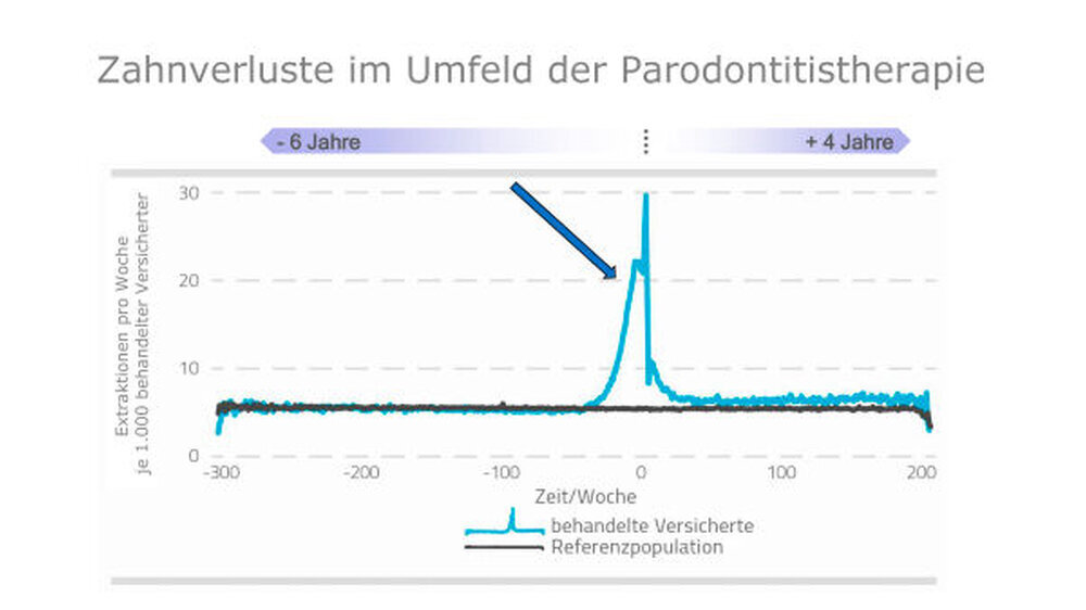 Zielkriterium der Analysen war der Zahnerhalt respektive der Zahnverlust. "Dieses eindeutige Ereignis wurde gewählt, um besonders die Nachhaltigkeit der Parodontitistherapie im Versorgungsalltag zu beurteilen", erklärt Studienautor Walter. Die Ergebniss